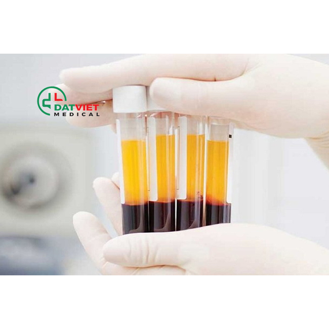 có nên mua máy sinh hóa tự động