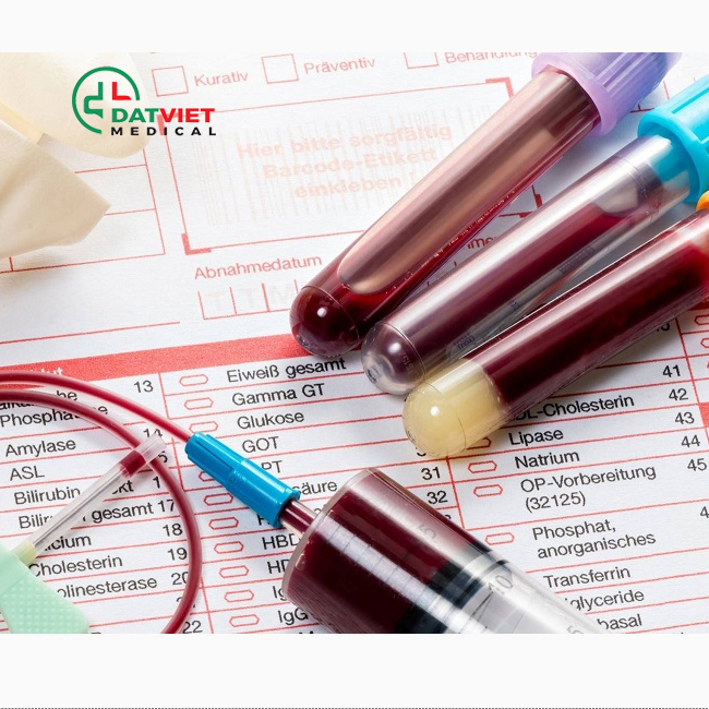 xét nghiệm huyết học mono có ý nghĩa gì