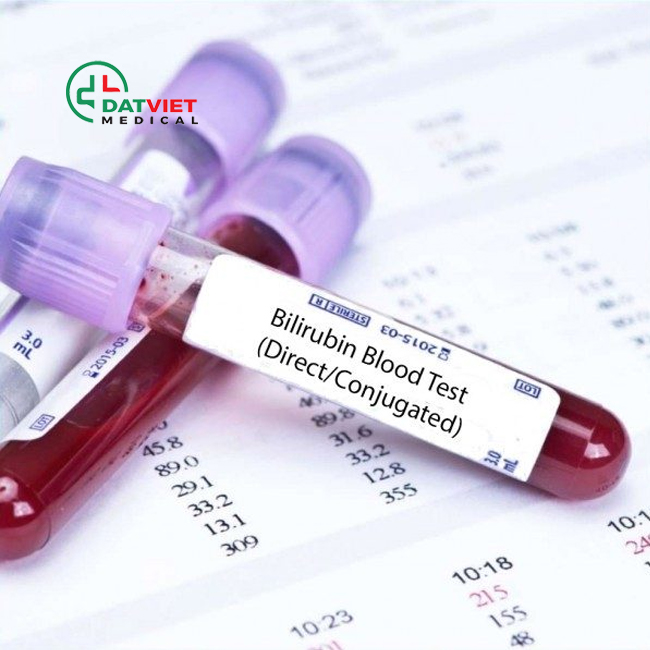 xét nghiệm huyết học mono là gì