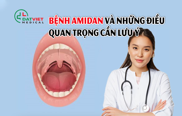 những điều cần lưu ý về bệnh amidan