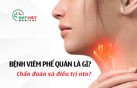 cách điều trị bệnh viêm phế quản hiệu quả