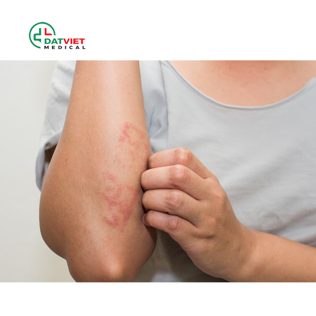 chỉ số wbc trong máu là gì