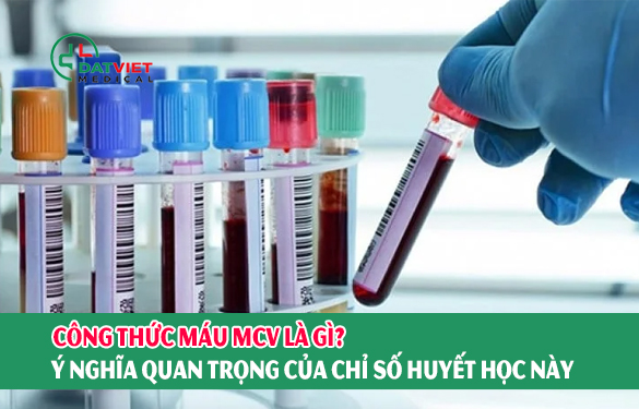 công thức máu mcv là gì