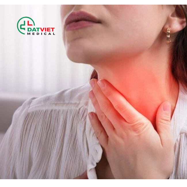dấu hiệu bệnh viêm họng là gì