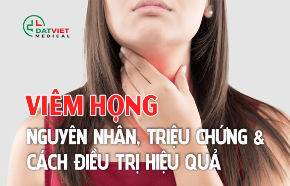 nguyên nhân triệu chứng gây ra bệnh viêm họng