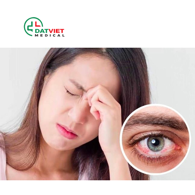 những căn bệnh mùa hè dễ gặp