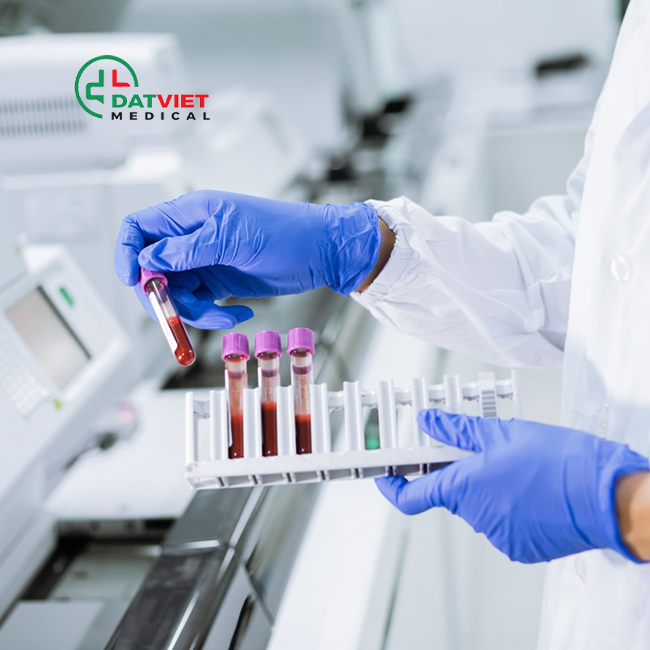 qc máy huyết học thực hiện thế nào
