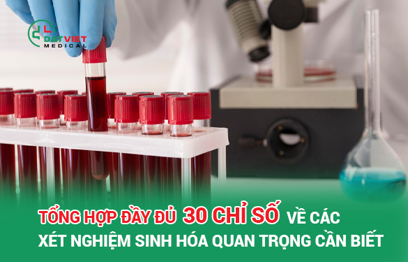 tổng hợp 30 chỉ số xét nghiệm sinh hóa quan trọng