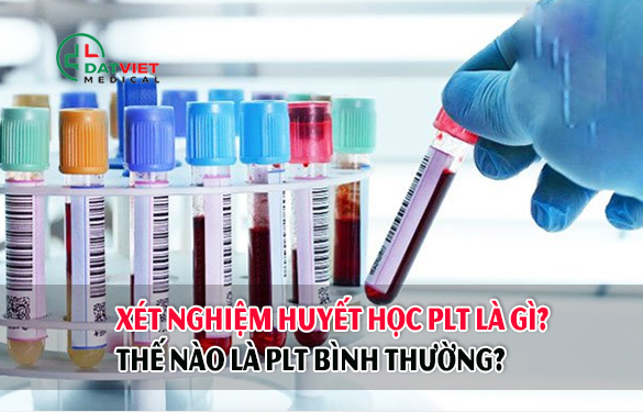 xét nghiệm huyết học plt thế nào là bình thường
