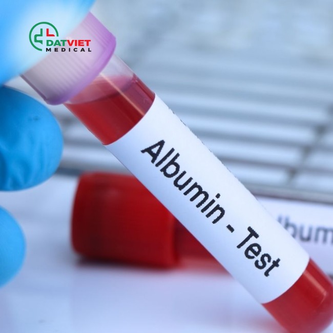 tìm hiểu ý nghĩa của chỉ số albumin trong máu