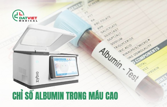 chỉ số albumin trong máu cao