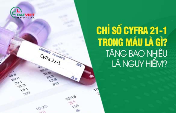 tìm hiểu về ý nghĩa của chỉ số cyfra 21 là gì