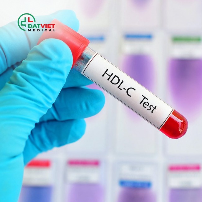 vai trò của chỉ số hdl c trong máu là gì