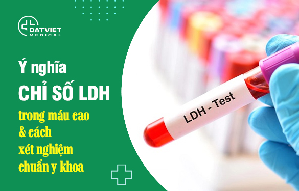 chỉ số ldh trong máu cao có sao không