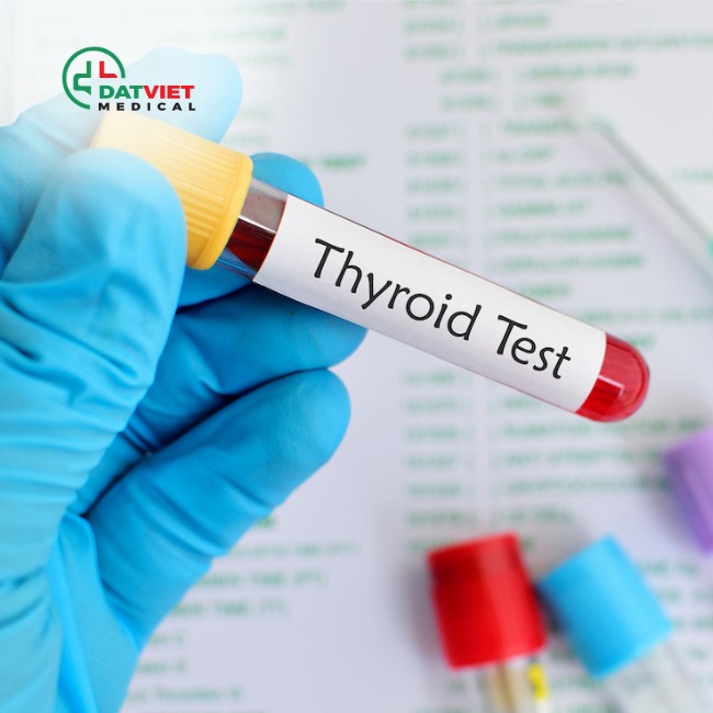 vai trò của chỉ số t3 trong xét nghiệm máu