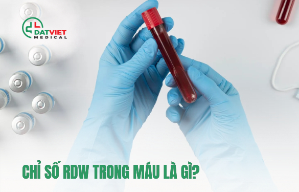 ý nghĩa của chỉ số rdw trong máu là gì