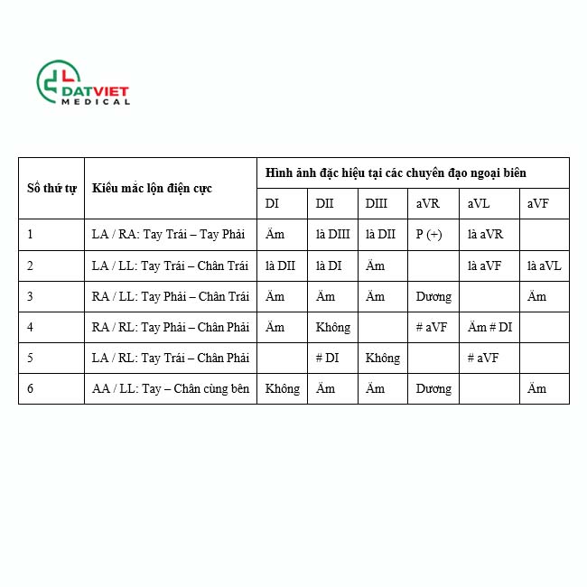 mắc máy điện tim là gì