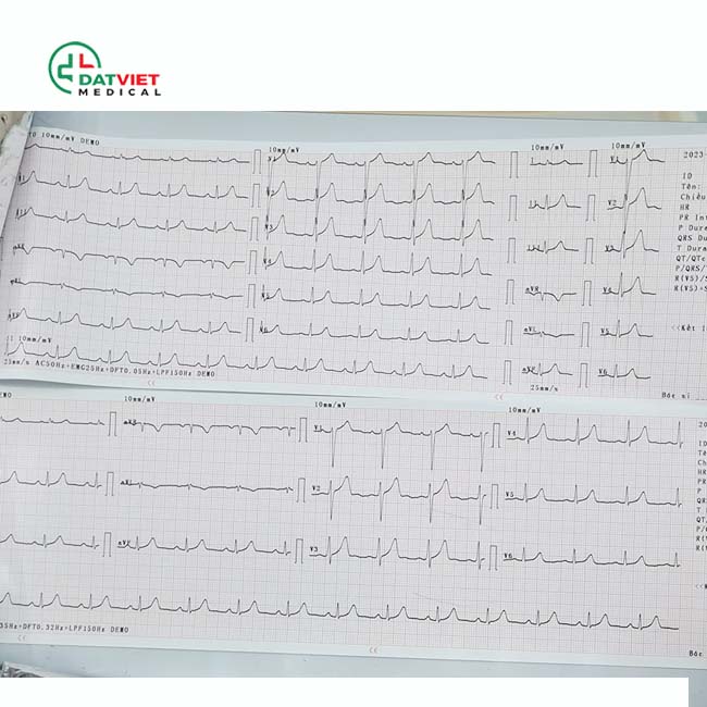 mắc máy điện tim nào được dùng nhiều