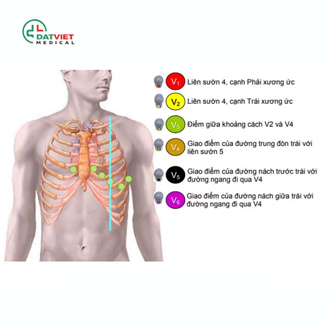 mắc máy điện tim tốt như nào
