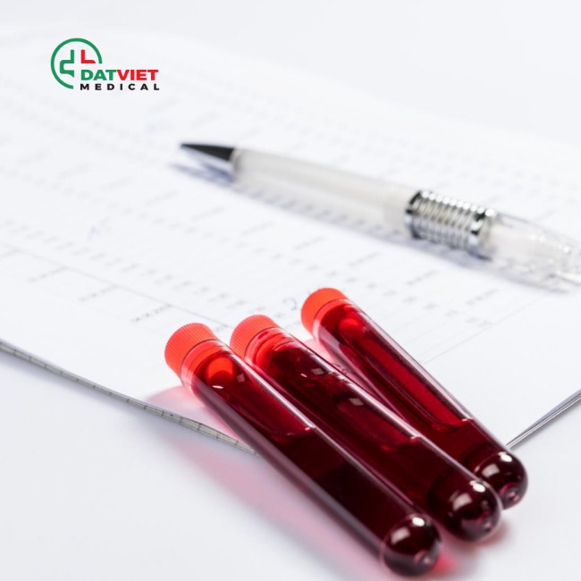 mua máy xét nghiệm miễn dịch exi 1820