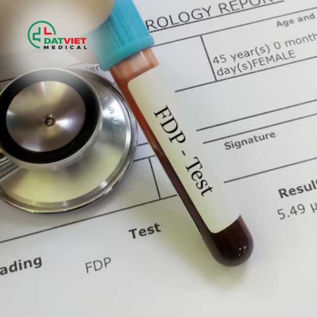 máy xét nghiệm máu uy tín