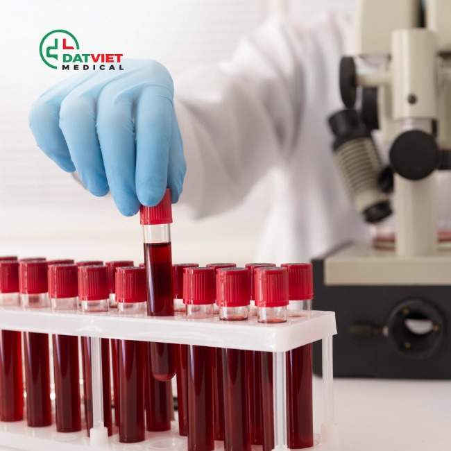 máy xét nghiệm miễn dịch chuẩn hãng ở đâu