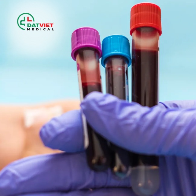 máy xét nghiệm miễn dịch exi 1820 chuẩn hãng