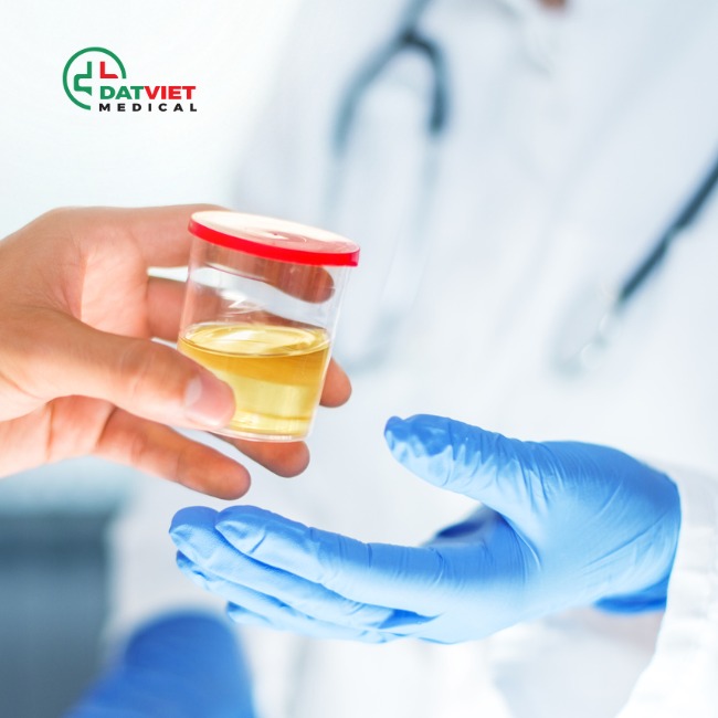 dòng máy xét nghiệm nước tiểu 13 thông số nào uy tín