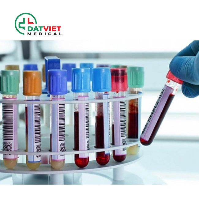 máy xét nghiệm sinh hóa có nguyên lý hoạt động ra sao
