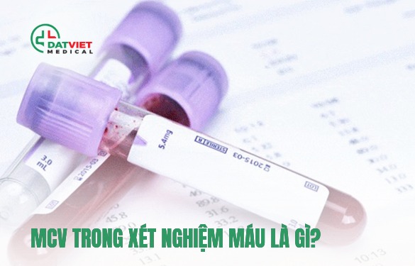 mcv trong xét nghiệm máu là gì