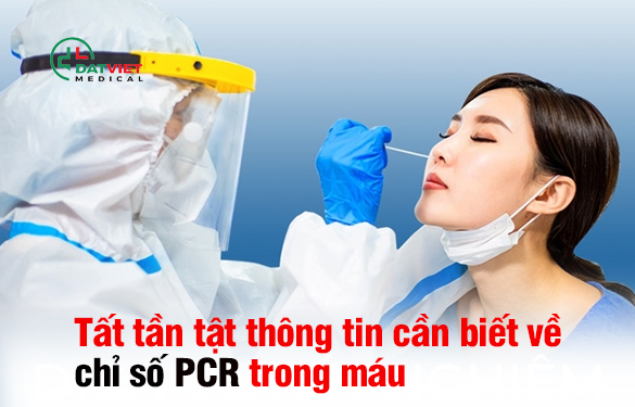 những thông tin cần lưu ý về xét nghiệm pcr