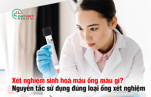 ống xét nghiệm sinh hóa