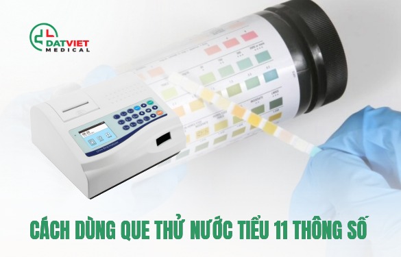 que thử nước tiểu 11 thông số 11 tiểu