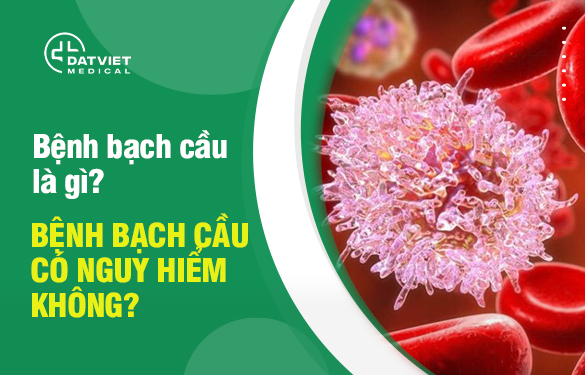 tìm hiểu về bệnh bạch cầu là gì