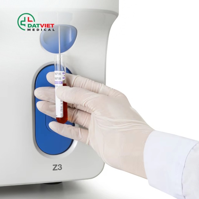 tìm hiểu về chỉ số mchc trong xét nghiệm máu