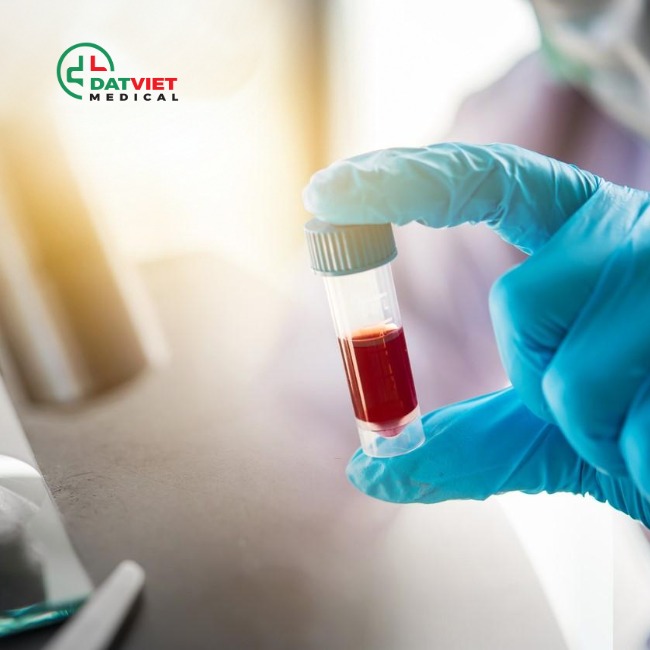 khám phá vai trò của máy miễn dịch