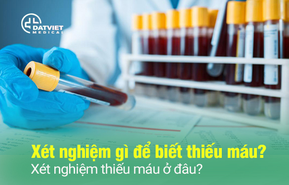 xét nghiệm gì để biết thiếu máu