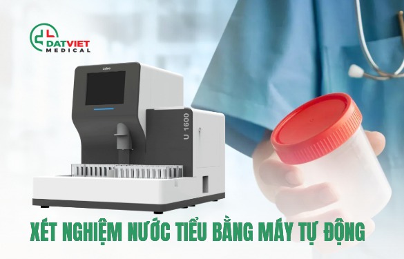 máy xét nghiệm nước tiểu nào tốt