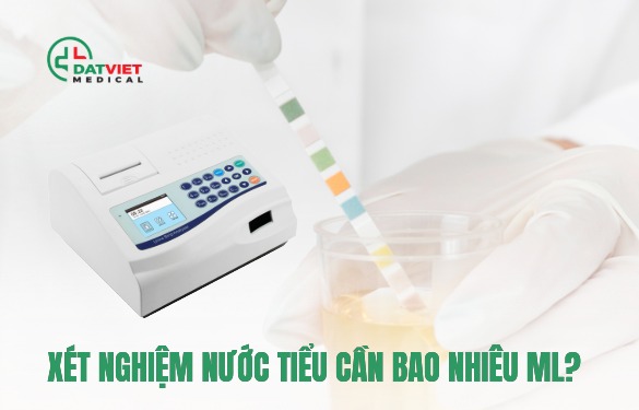 xét nghiệm nước tiểu cần bao nhiêu ml là đủ