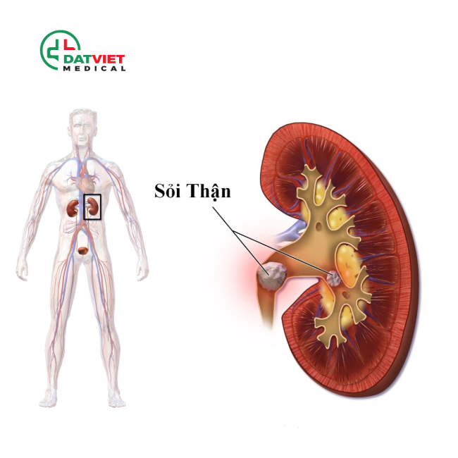 xét nghiệm nước tiểu biết bệnh gì