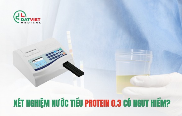 xét nghiệm nước tiểu protein chuẩn hãng
