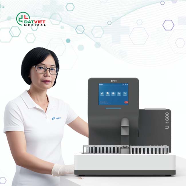 tìm hiểu xét nghiệm tế bào nước tiểu bằng máy tự động