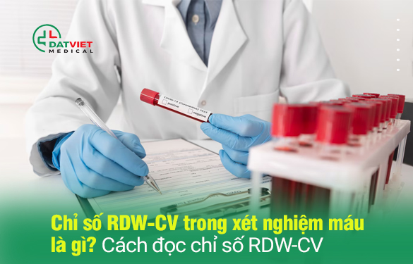 tìm hiểu ý nghĩa rdw trong máu  là gì