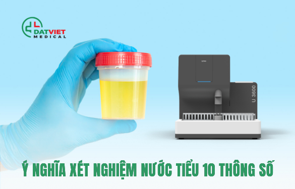ý nghĩa của máy xét nghiệm nước tiểu
