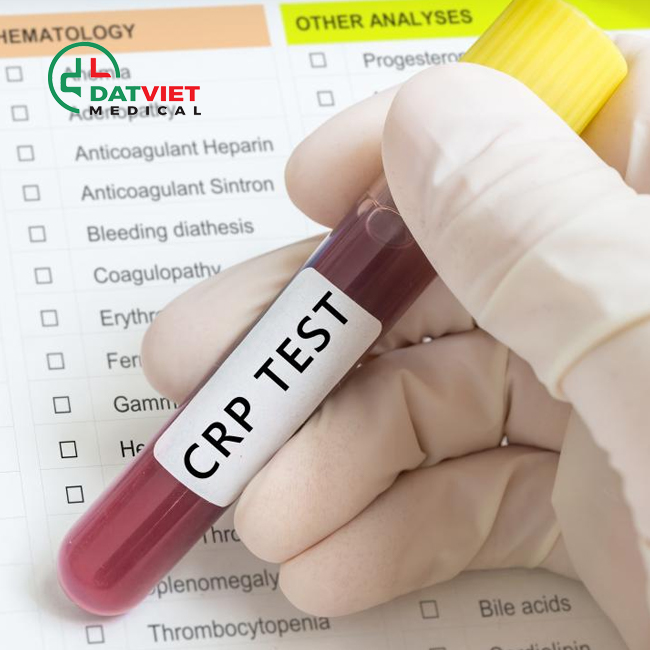 sự quan trọng của crp là gì